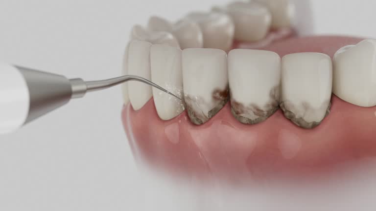 Reliable Dental contractor in Milan, OH by Dentist Open Now
